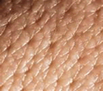 出典：人間の皮膚
Human-Skin-Pores.jpg#id=13&iurl
